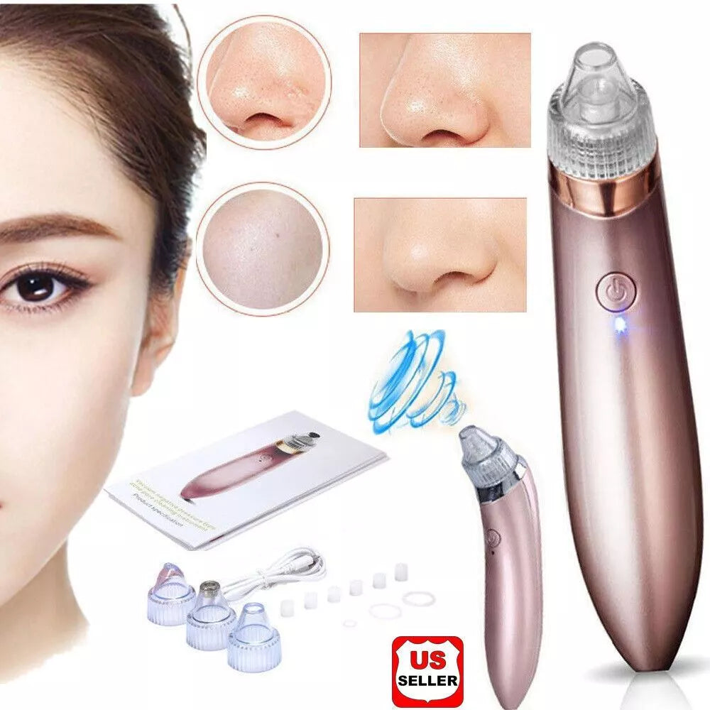 Blackhead Remover Vacuum Acne Cleaner – Deep Pore Cleansing for Flawless Skin